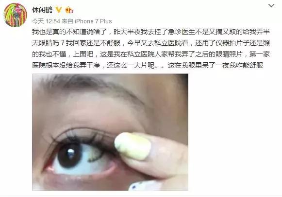 隐形眼镜碎了会在哪个位置,隐形眼镜在眼里面碎了一半