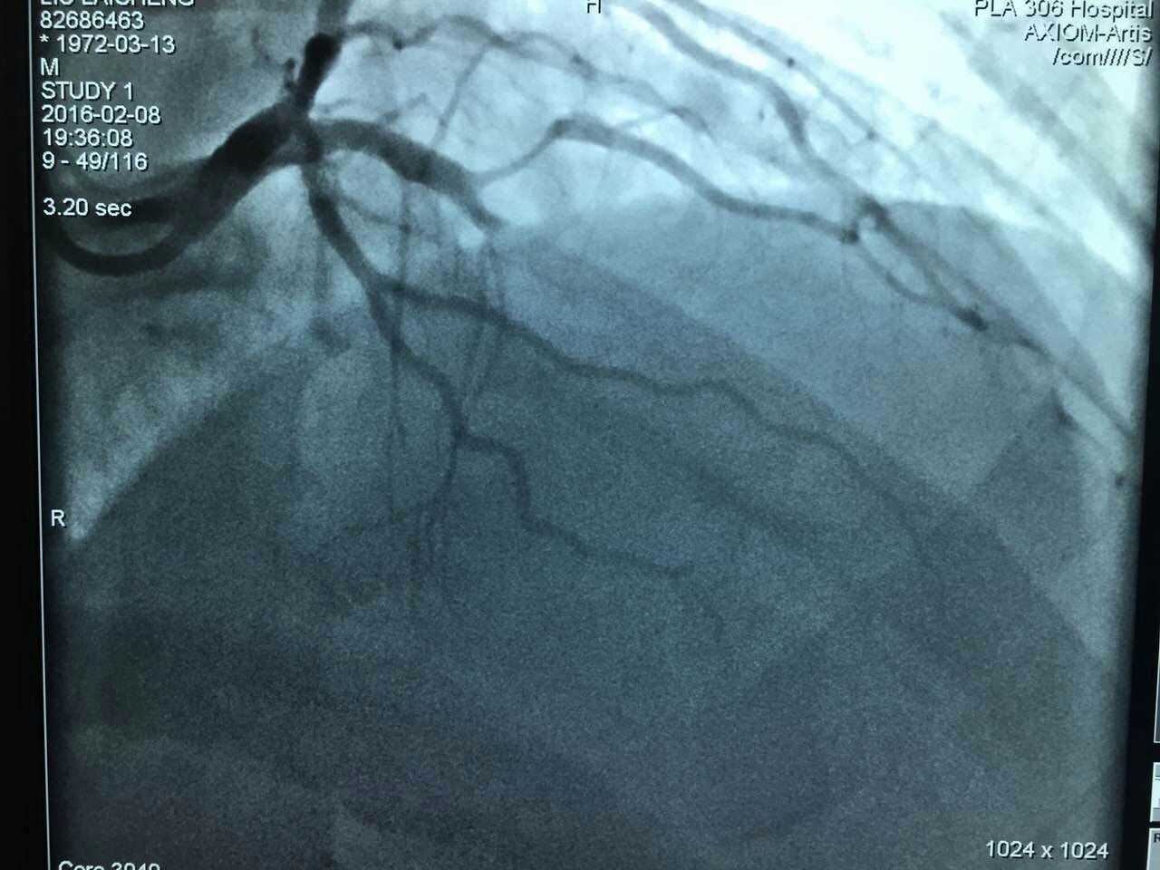 解放军306医院除夕之夜倒计时与正计时