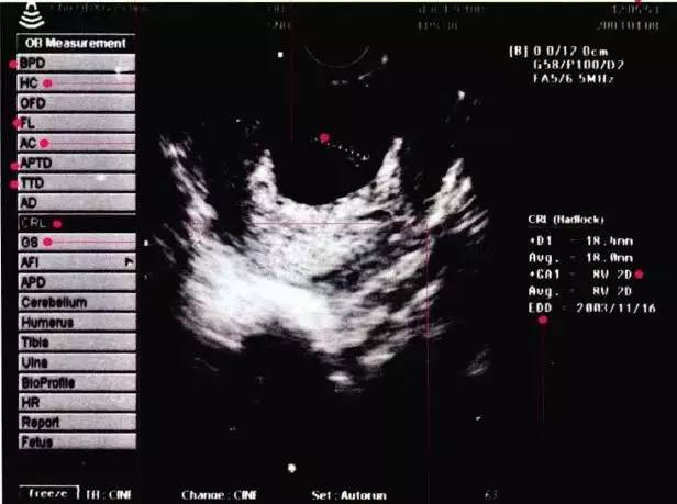 爆炒猪肠子图片,爆炒竹蛏子图片