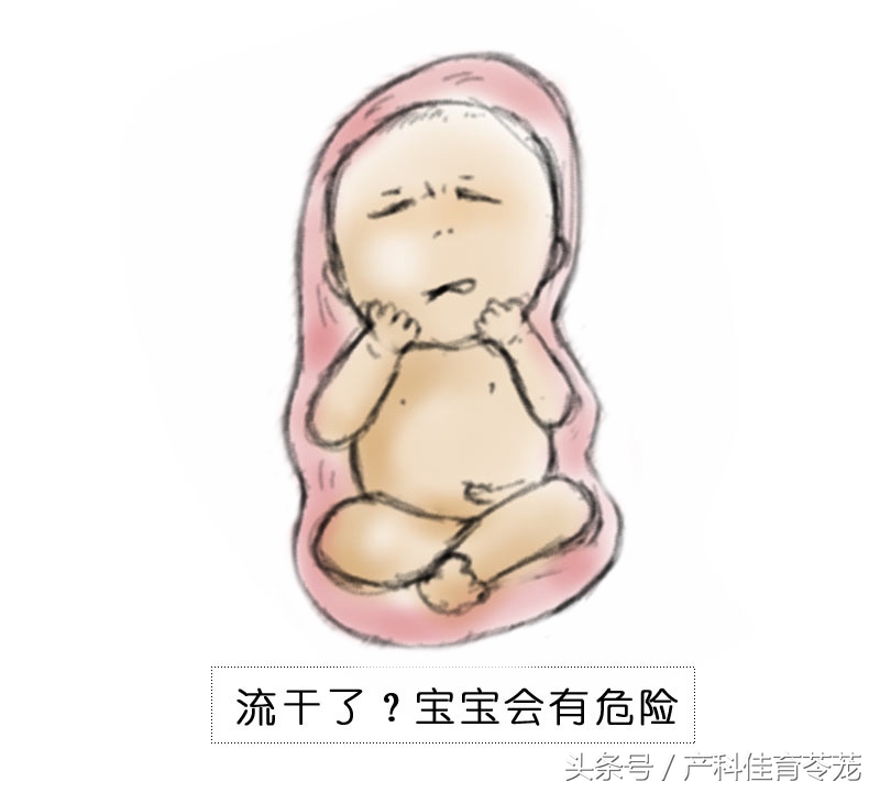 破水了，害怕吗？产科医生教您这样应对