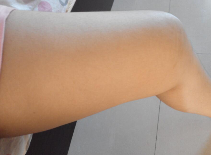 大腿胖是什么原因,大腿胖是因为缺什么