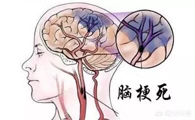 脑梗塞病人抽搐怎么回事,脑梗塞患者头晕怎么回事
