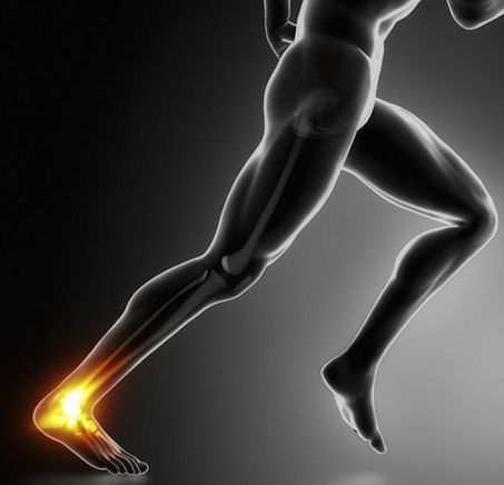 脚崴了怎么办判断是否骨折,脚崴了怎么办视频