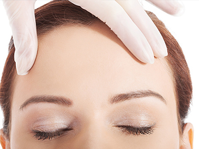 自体脂肪丰额头效果怎样,自体脂肪丰额头效果明显吗