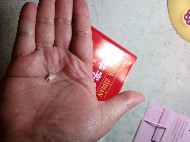 儿童乳牙断了需要拔吗,孩子的乳牙断了是怎么回事