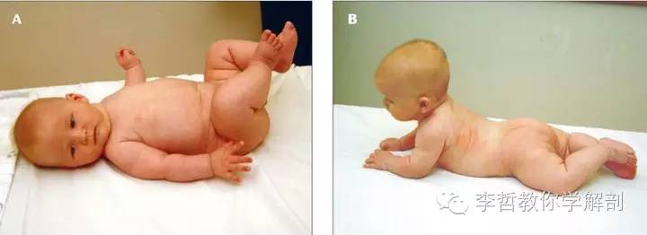 学员精彩笔记(2)|什么是后表线?它到底在人体中扮演怎样的角色