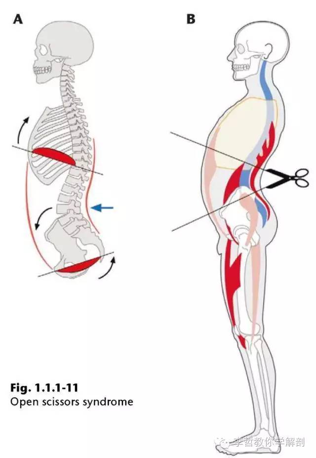 学员精彩笔记(2)|什么是后表线?它到底在人体中扮演怎样的角色