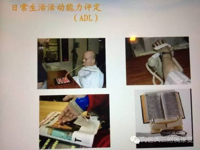 康复科到底是什么,康复大专是干什么的