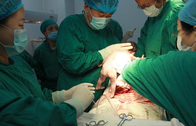 剖腹产要经过几道工序,剖腹产只需切一层