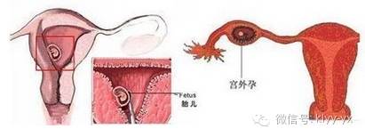 生活方式孕期腹痛很着急，读懂它对症处理不是事！