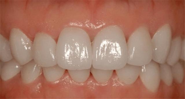 牙龈牙齿不好怎么办,牙龈不好用什么药恢复得好