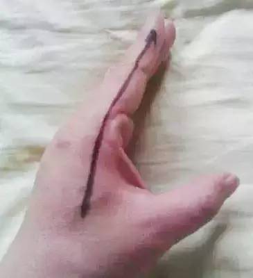 咳嗽便秘特效药,咳嗽咽痛牙痛拉肚子是什么病