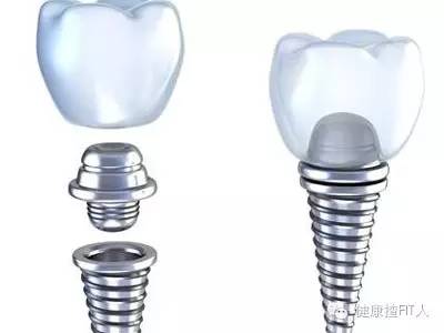 缺牙种植不好还有其他什么方法,老人缺牙去哪里种植放心