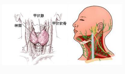 甲状腺手术用胶水粘伤口怎么护理,甲状腺手术后伤口怎么护理