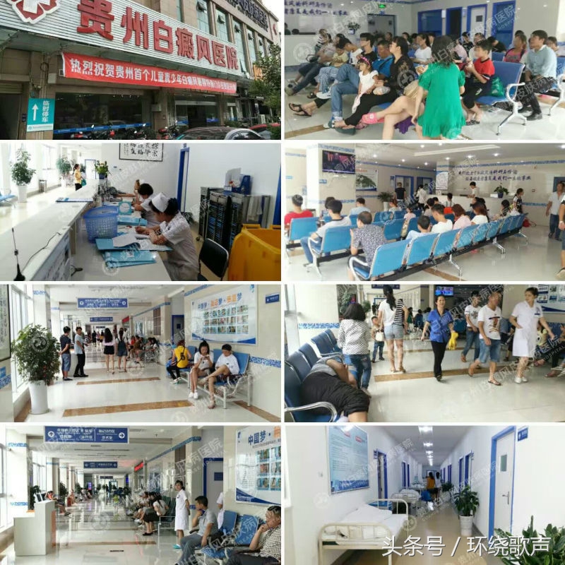 白癜风患者做到这几点不吃亏,白癜风治愈完全靠运气