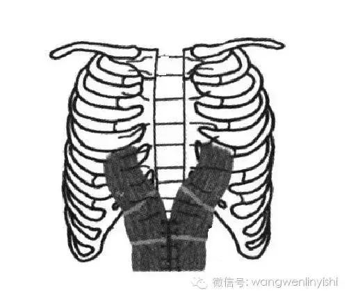 图与真相：什么是胸骨裂？
