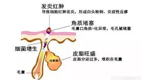 皮肤干燥贴补水面膜,冬天皮肤干燥起皮好物推荐