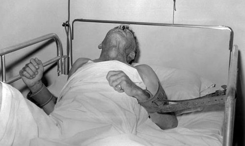 如何有效的防止狂犬病,要怎样才能有效防治狂犬病