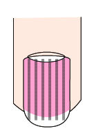 指甲出现白点与竖纹是怎么回事,指甲出现白点什么原因