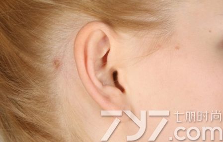 孕妇耳朵痒是怎么回事四大原因你是哪一个