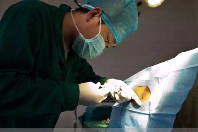 剖腹产恢复很好的照片,剖腹产完全恢复照片