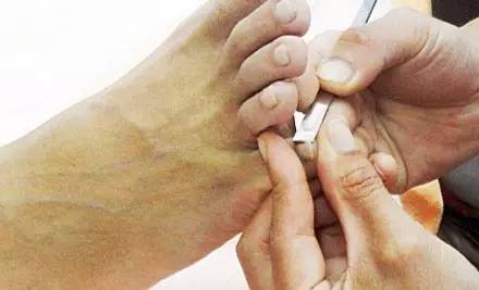 新白马寺：脚部关节痛如何预防，请保持脚下健康！