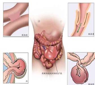 肚子老是咕噜咕噜地叫应吃什么药,肚子总是咕噜咕噜叫别人听得到吗