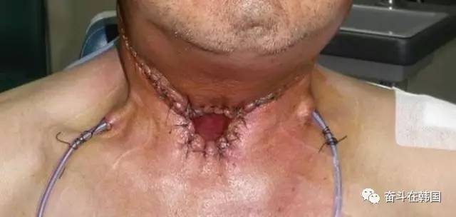 鐑熺洅寰堟伓蹇冪殑鏄粈涔堢儫,琚姝㈢殑鍏棣欑儫鍥剧墖