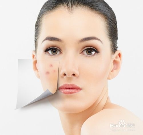 快速让皮肤变好消除痘痘的方法,怎么样才能不长痘痘皮肤变好