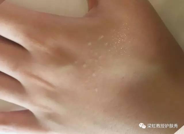 梁虹医疗美容,梁虹医美护肤品