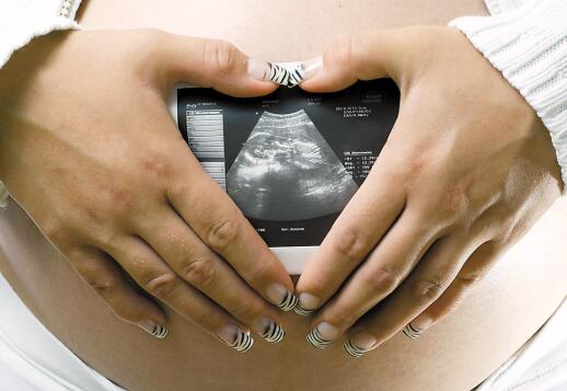 b超单怎么看单双,如何看懂b超单图片