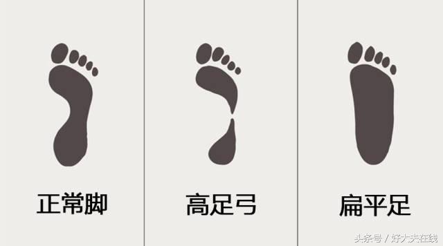 有的鞋走路脚后跟痛怎么回事,走一走就脚痛是鞋的原因吗