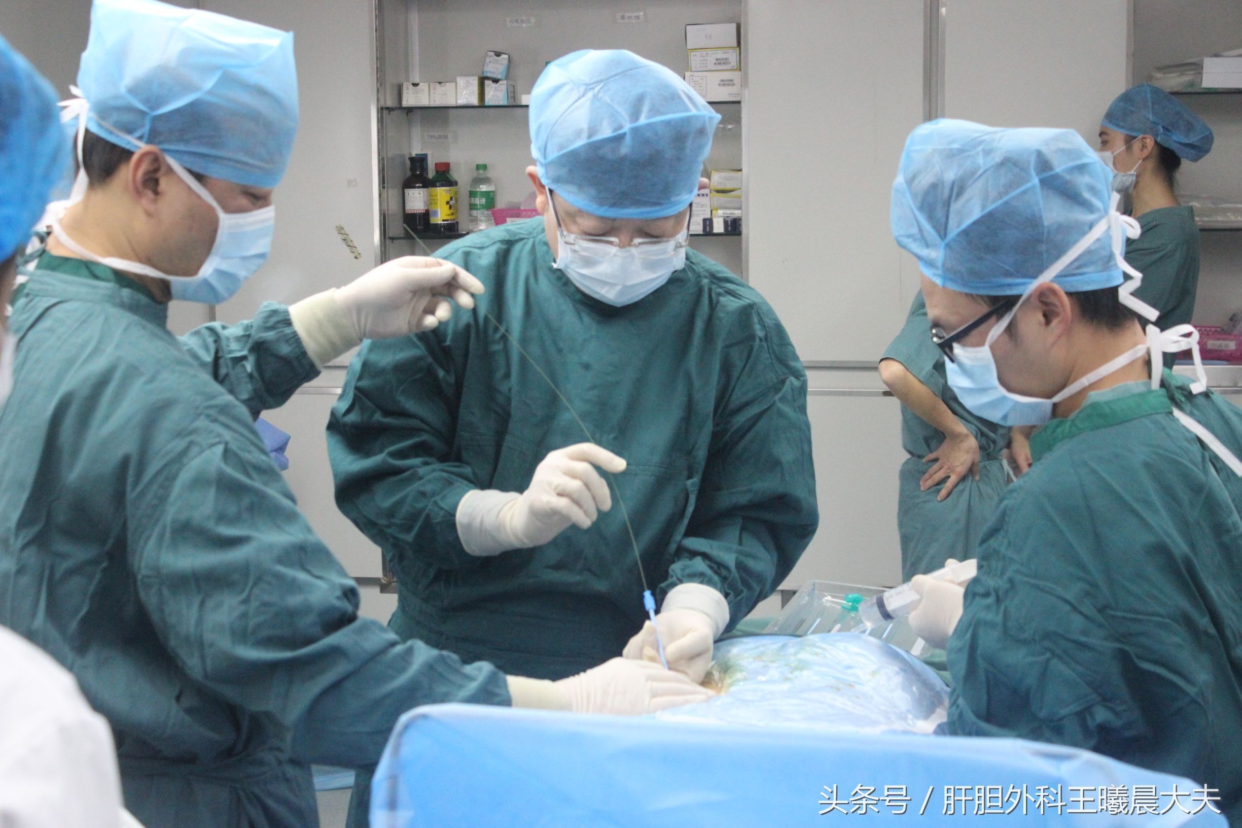 “超微创”:笔芯粗细的通道取出结石