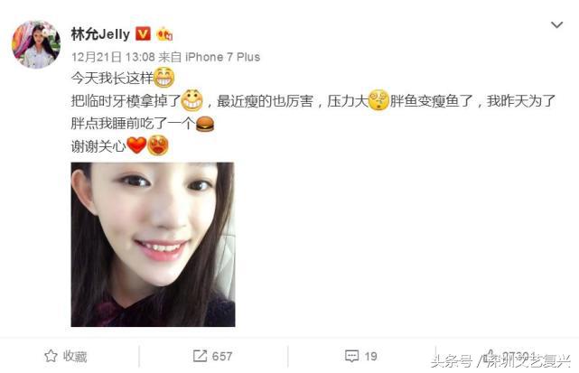 林允整牙效果怎么样,林允整牙后变化图片