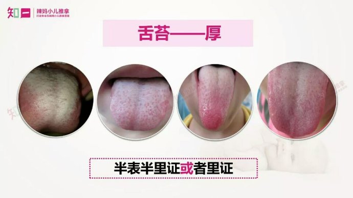 舌苔白厚是什么原因怎么检查,舌苔厚薄如何判断