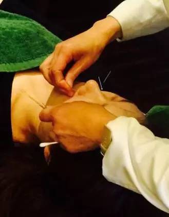 鼻炎患者有什么需要注意的,鼻炎患者开车违法吗