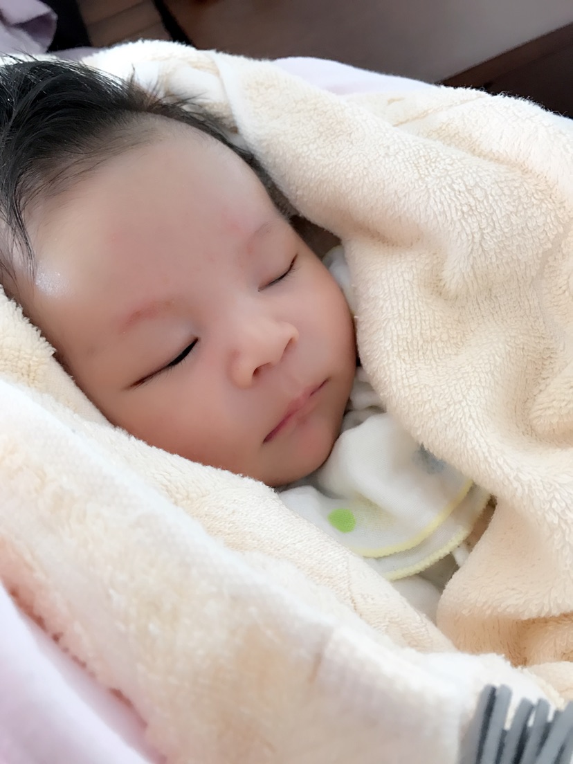 黄疸光晒能解决问题吗,与黄疸作斗争