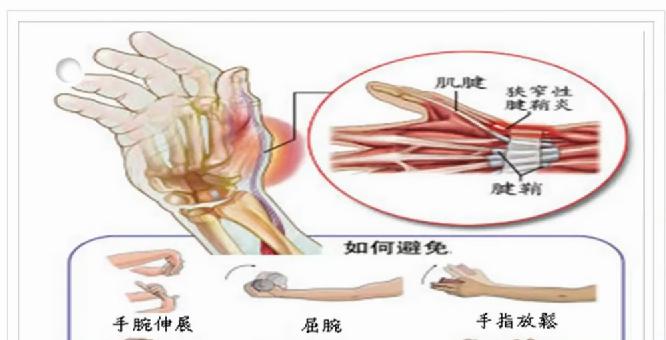 终局之战奇异博士手势,奇异博士手势gif图