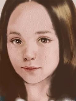 做线雕多久可以敷面膜,敷100次面膜不如打一次水光图片