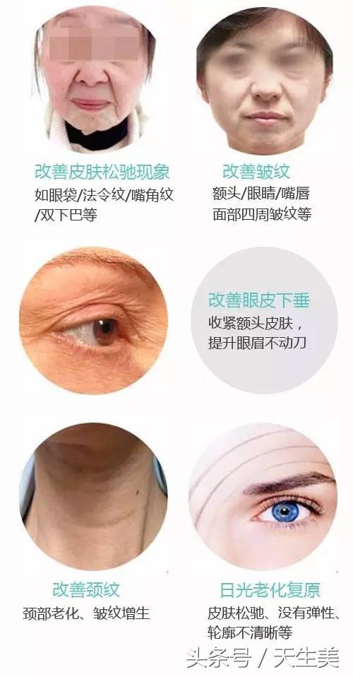 超声刀值得做吗 (超声刀怎么样啊)