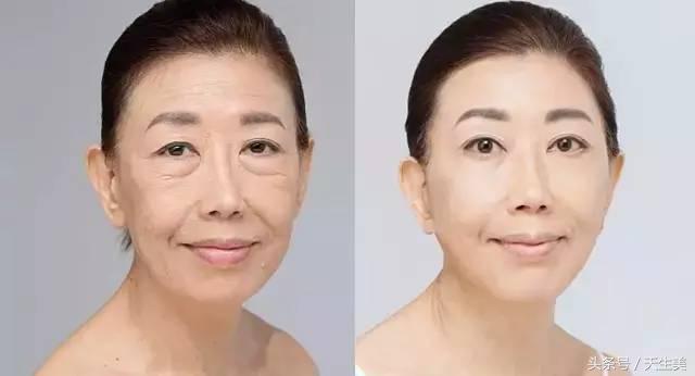 超声刀值得做吗 (超声刀怎么样啊)