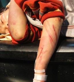 男孩疯狂自虐,浑身伤痕累累,一切都是为了妈妈