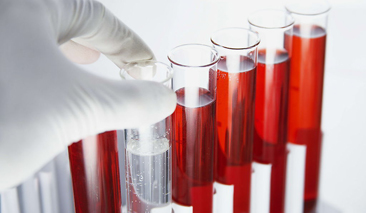 发现血尿后做什么检查,尿常规可以发现血尿吗