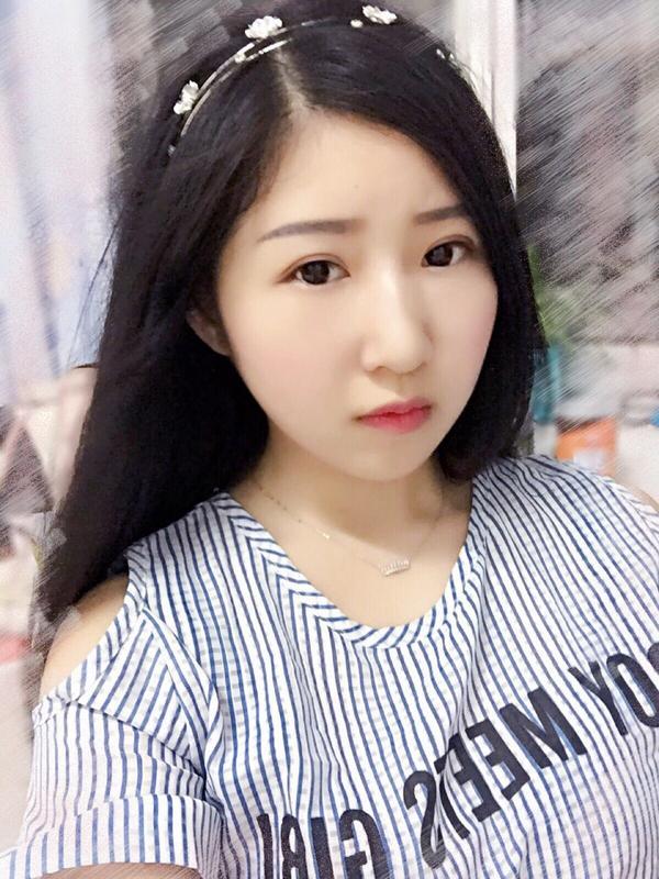 韩式三点双眼皮拆线图片,韩式双眼皮三点好还是五点好