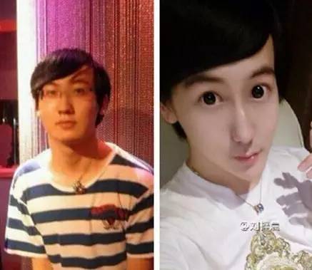 割双眼皮、垫鼻子、幽灵医生……一篇文章为你揭秘韩国整形