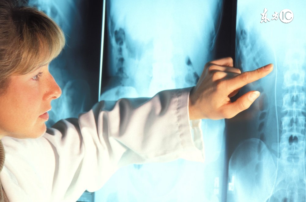 骨刺消痛液药方,治骨刺的特效药方