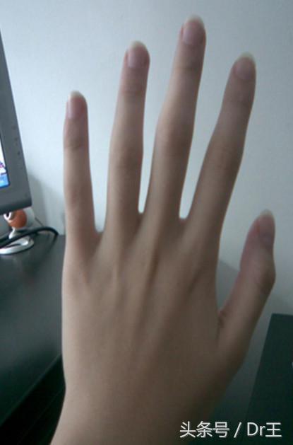 在美甲店做了美甲后手指一直起皮,在美甲店做的美甲掉漆了