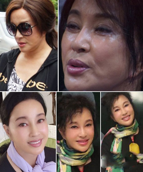 刘晓庆整容前后对比照吓人驻颜有术是骗人的！