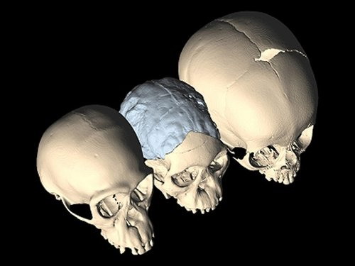 人类分娩困难的好处,分娩困难怎么办