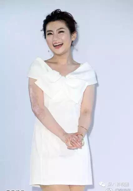 烧伤事件双方粉丝互撕六年，他们承受无尽痛苦，却总是被揭旧伤疤